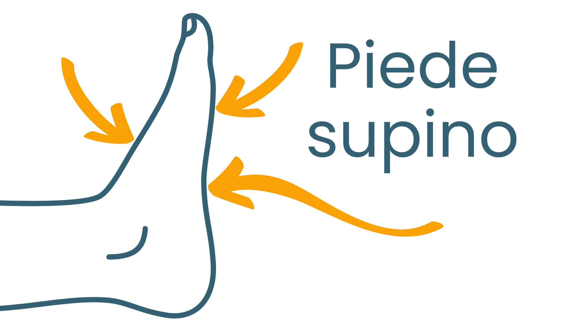 Piede supino